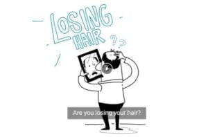 HairLoss